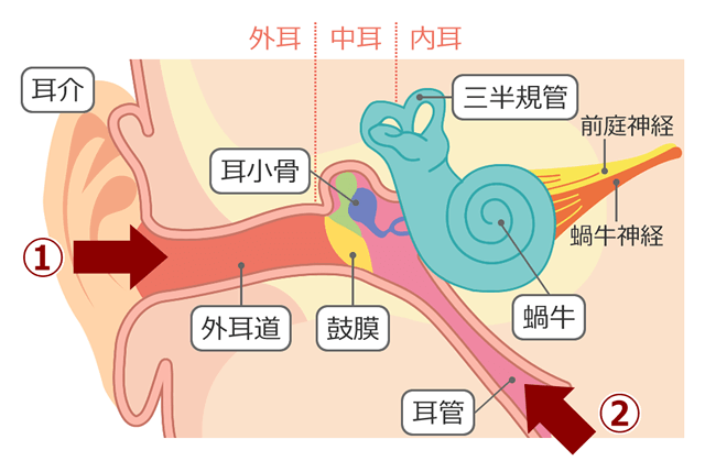 中耳炎 切開 後 耳 だれ いつまで