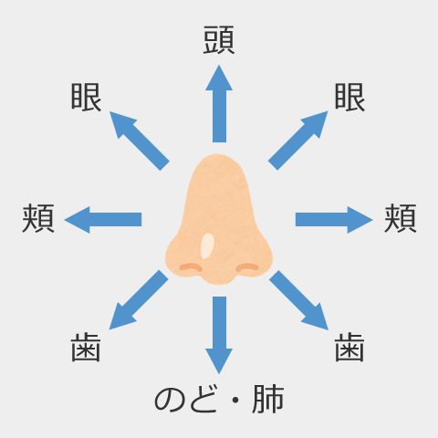 副鼻腔炎の症状